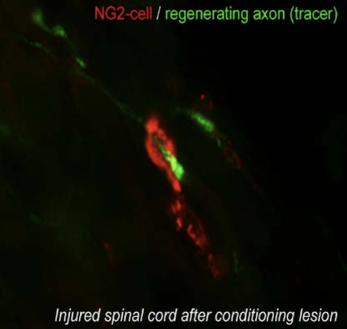 injured-spinal-chord-after-conditioning-lesion.png